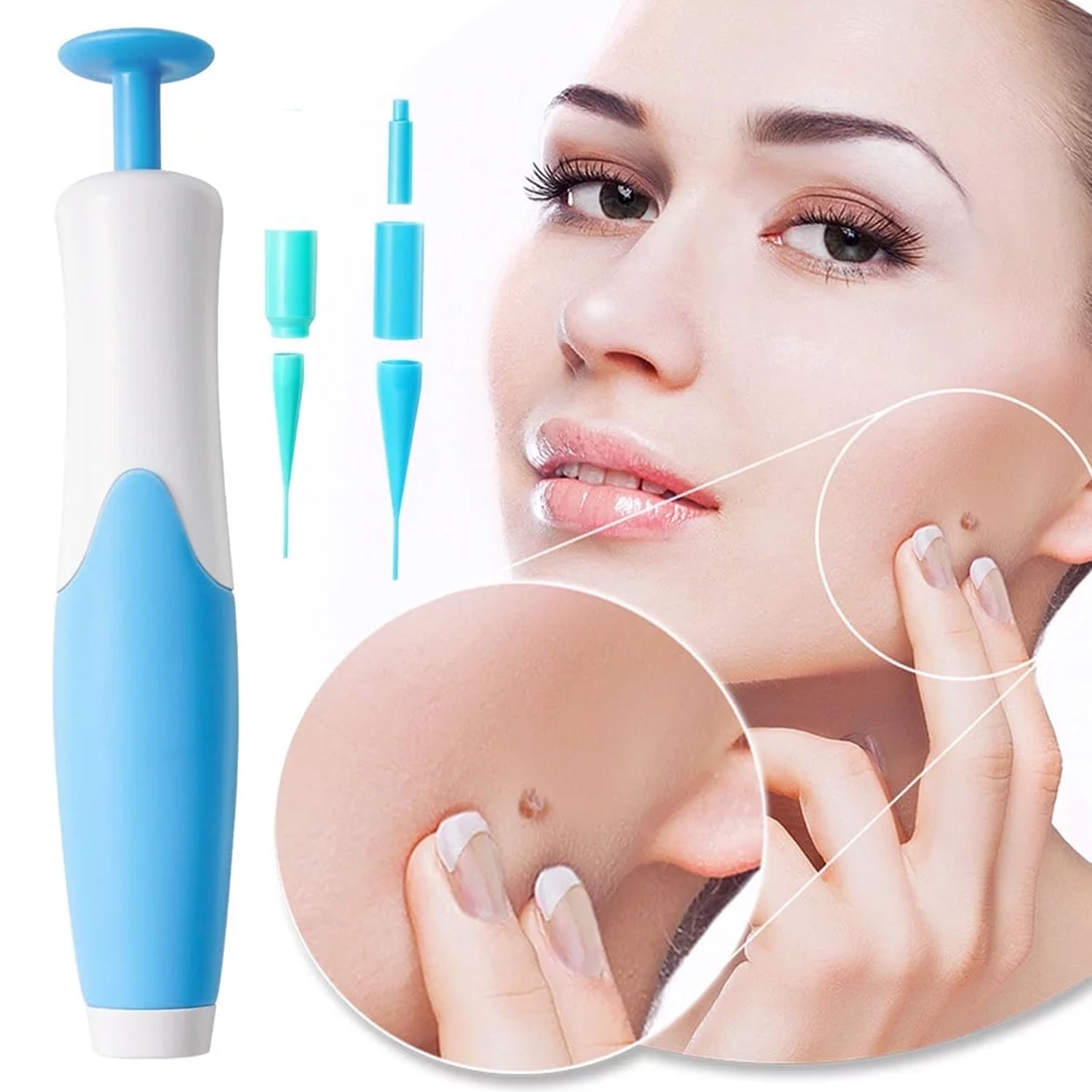 Skin Tag Remover Kit 2 in 1 for Micro to Large (2 mm - 8 mm / 1 Set) Signaturekarts