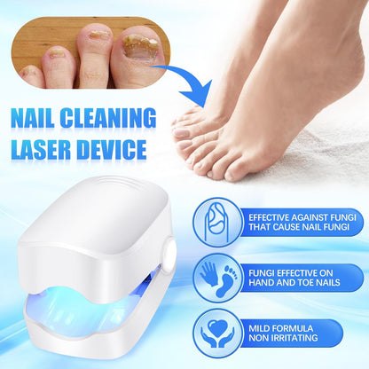 Rechargeable Nail Fungus Laser – Anti-Fungal Device Toenails, Hands & Feet (Home Use) signaturekarts