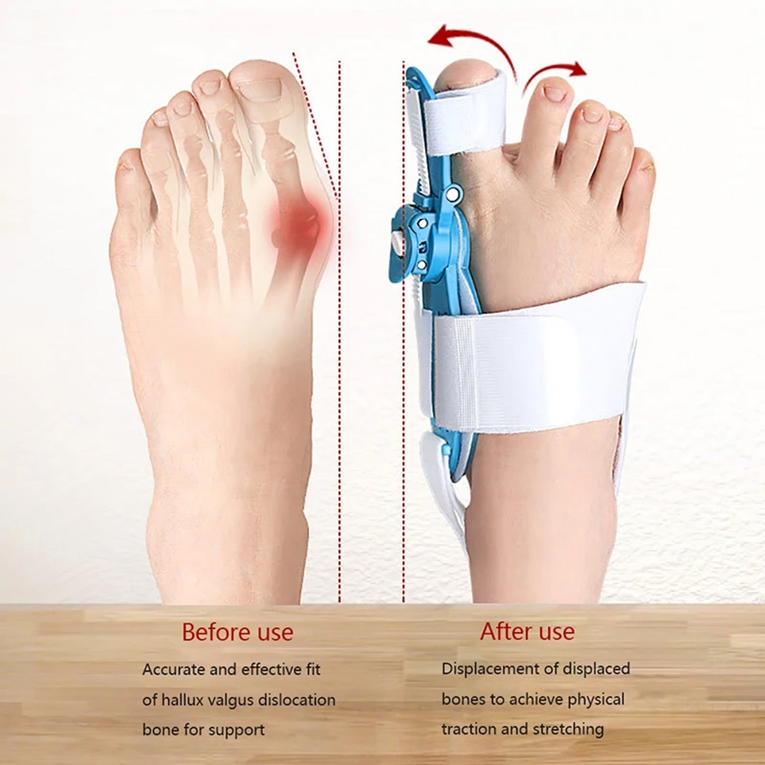 Adjustable Bunion Support Splint – Hallux Valgus Corrector for Men & Women signaturekarts