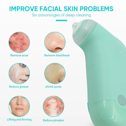 Mini Handheld Vacuum Blackhead Remover – Facial Massage & Spot Lifting (1 Pc) Signaturekarts