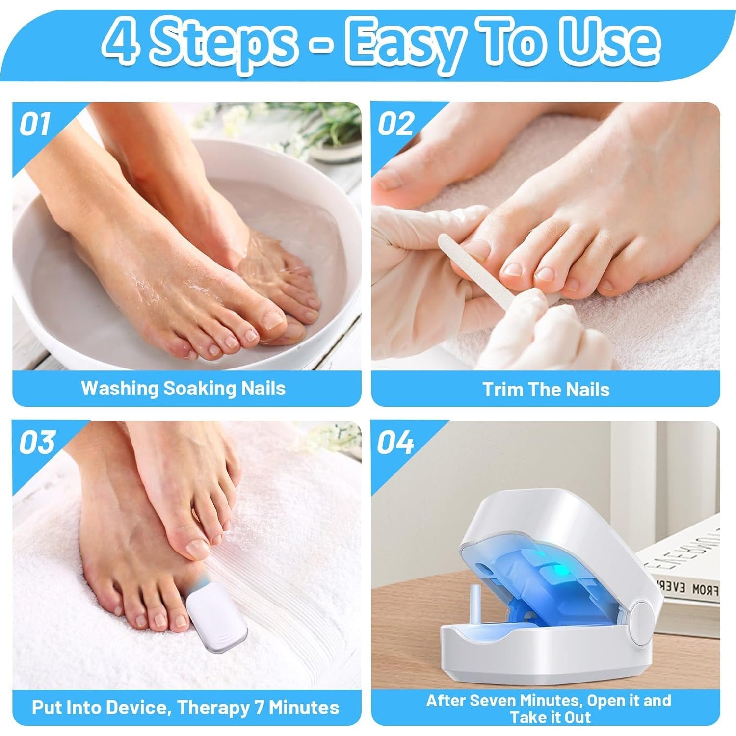 Rechargeable Nail Fungus Laser – Anti-Fungal Device Toenails, Hands & Feet (Home Use) signaturekarts