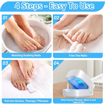 Rechargeable Nail Fungus Laser – Anti-Fungal Device Toenails, Hands & Feet (Home Use) signaturekarts