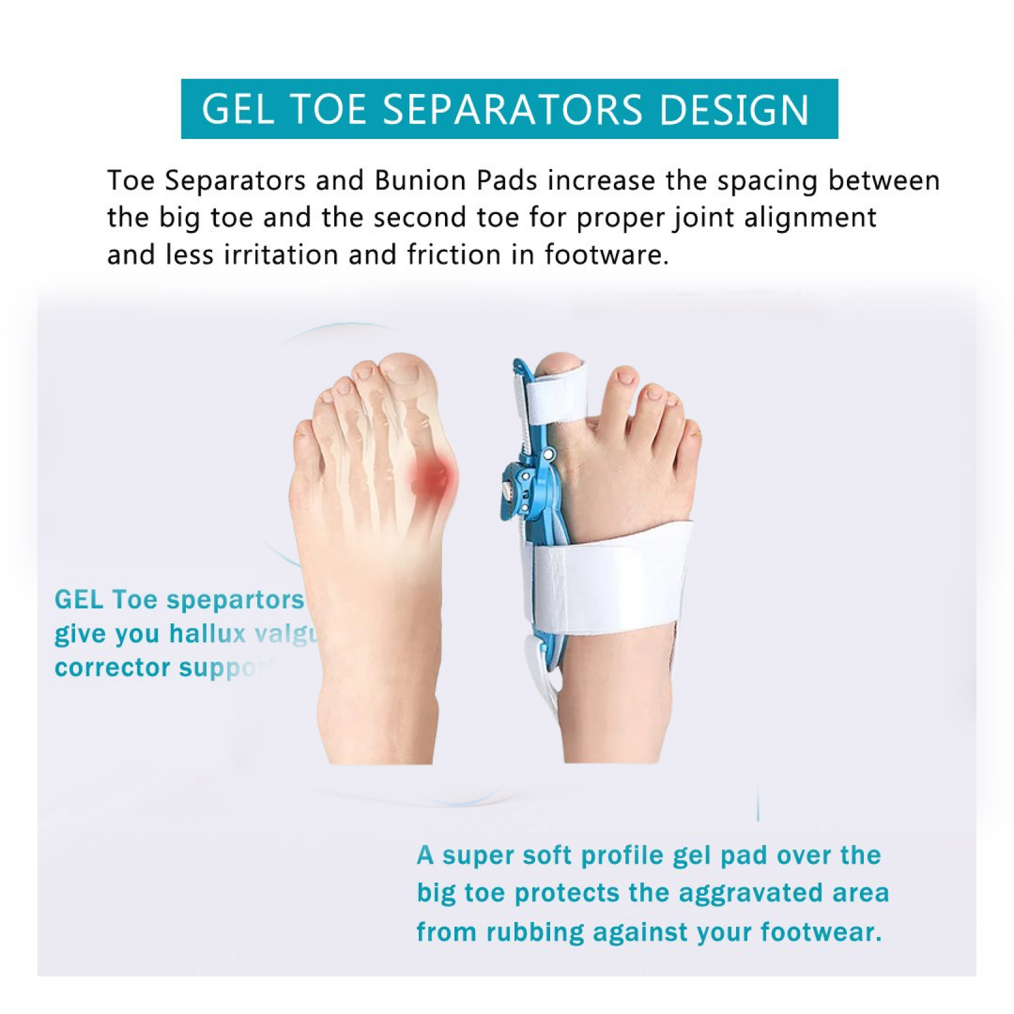 Adjustable Bunion Support Splint – Hallux Valgus Corrector for Men & Women signaturekarts