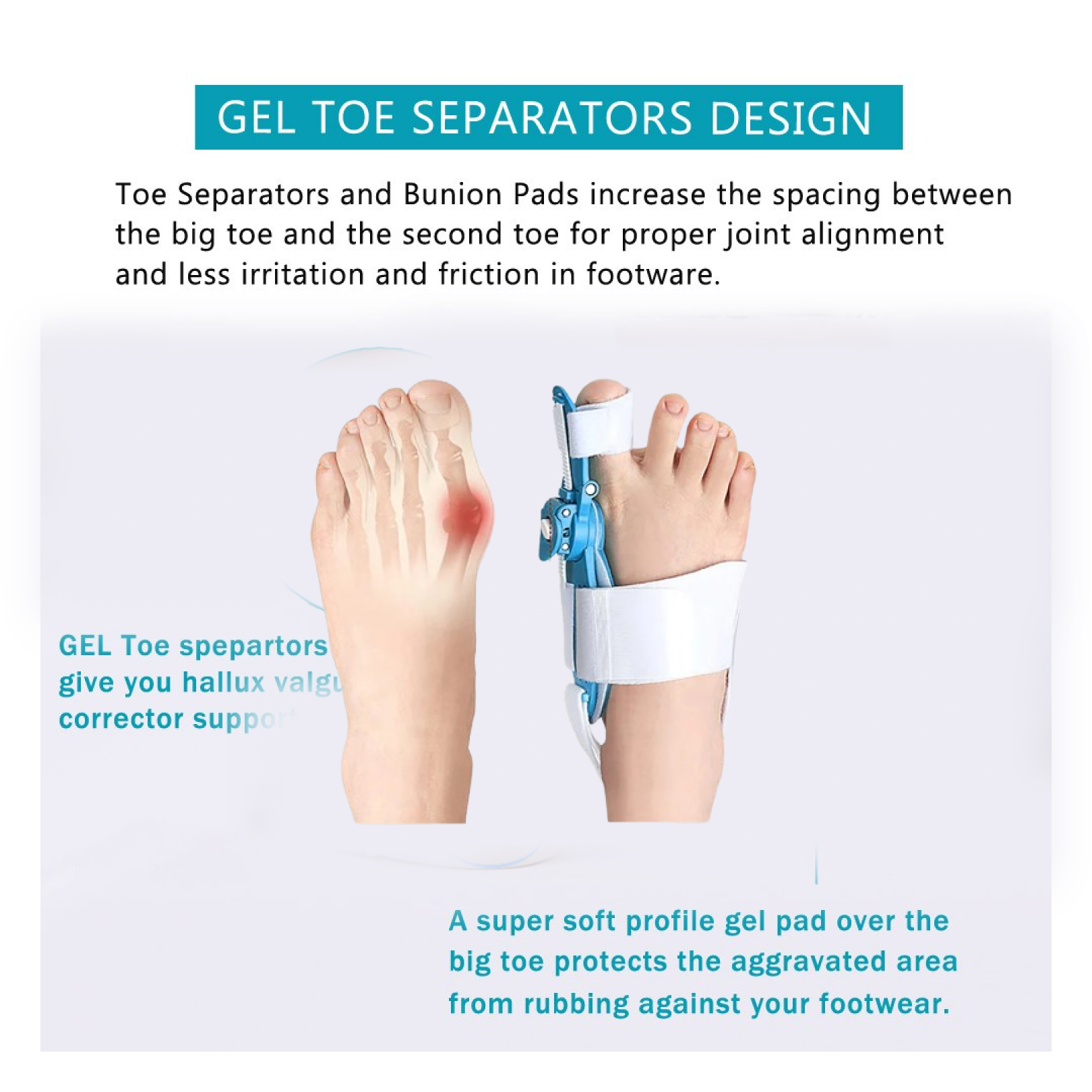 Adjustable Bunion Support Splint – Hallux Valgus Corrector for Men & Women signaturekarts