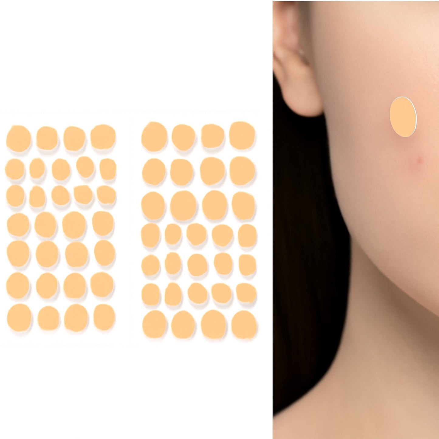 Pimple Patches for Face (1 Sheet Set) Signaturekarts