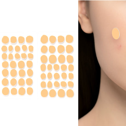 Pimple Patches for Face (1 Sheet Set) Signaturekarts